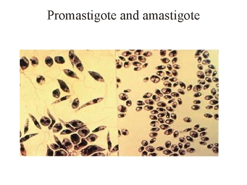 Promastigote and amastigote 