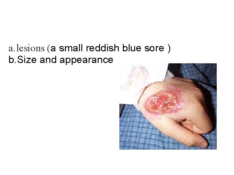  a. lesions (a small reddish blue sore ) b. Size and appearance 