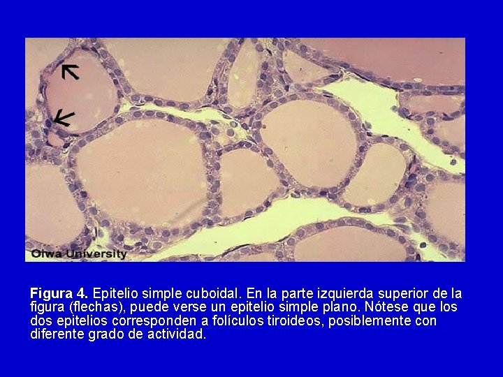 Figura 4. Epitelio simple cuboidal. En la parte izquierda superior de la figura (flechas),