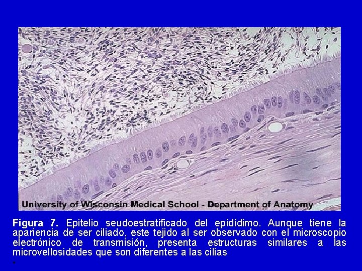 Figura 7. Epitelio seudoestratificado del epidídimo. Aunque tiene la apariencia de ser ciliado, este