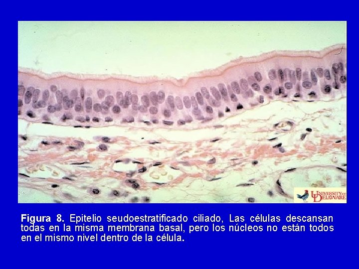 Figura 8. Epitelio seudoestratificado ciliado, Las células descansan todas en la misma membrana basal,