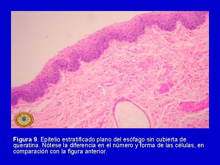 Figura 9. Epitelio estratificado plano del esófago sin cubierta de queratina. Nótese la diferencia