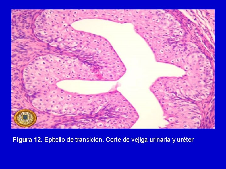 Figura 12. Epitelio de transición. Corte de vejiga urinaria y uréter 