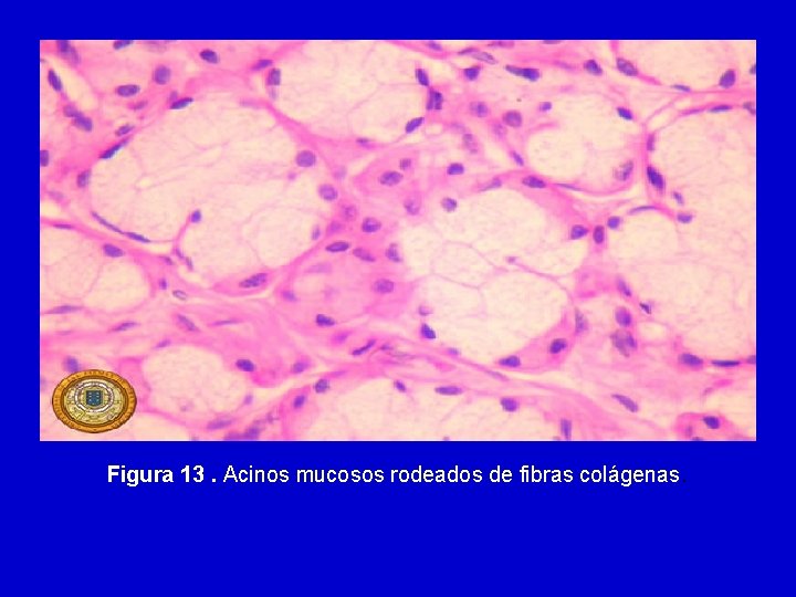 Figura 13. Acinos mucosos rodeados de fibras colágenas. 