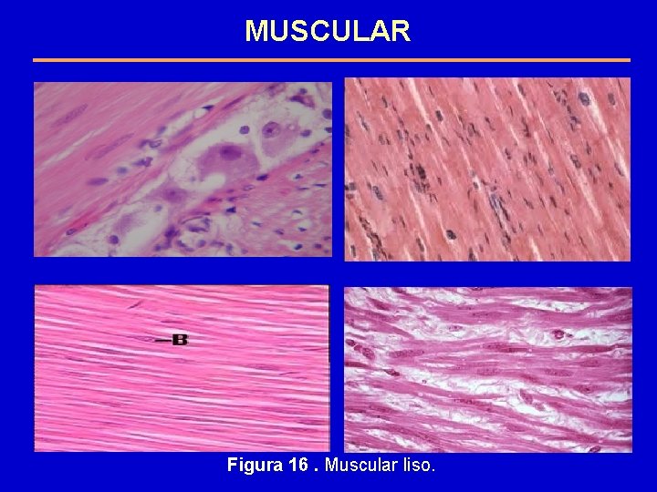 MUSCULAR Figura 16. Muscular liso. 