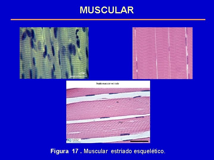 MUSCULAR Figura 17. Muscular estriado esquelético. 