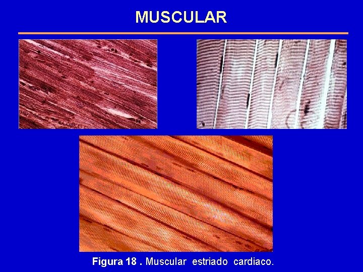 MUSCULAR Figura 18. Muscular estriado cardiaco. 