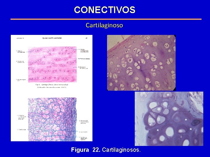 CONECTIVOS Cartilaginoso Figura 22. Cartilaginosos. CONECTIVOS Cartilaginoso Figura 22. Cartilaginosos.