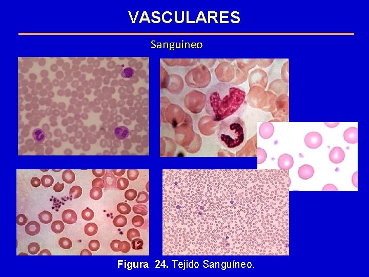 VASCULARES Sanguíneo Figura 24. Tejido Sanguíneo. 