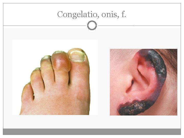 Congelatio, onis, f. 