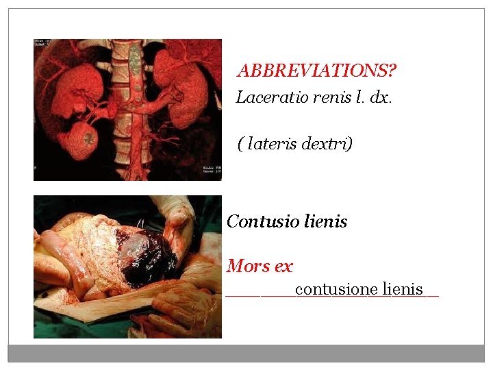 ABBREVIATIONS? Laceratio renis l. dx. ( lateris dextri) Contusio lienis Mors ex _________ contusione