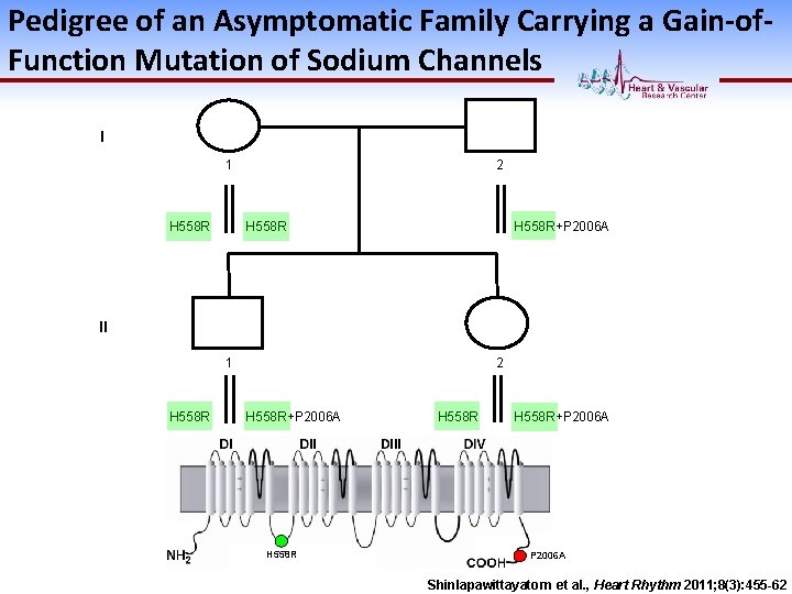 Pedigree of an Asymptomatic Family Carrying a Gain-of. Function Mutation of Sodium Channels I