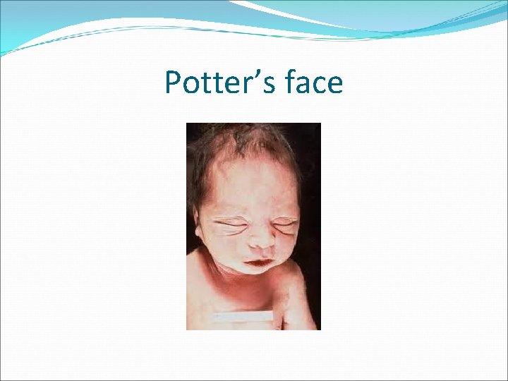 Potter’s face 