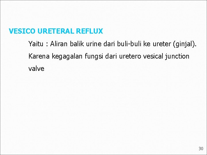 VESICO URETERAL REFLUX Yaitu : Aliran balik urine dari buli-buli ke ureter (ginjal). Karena