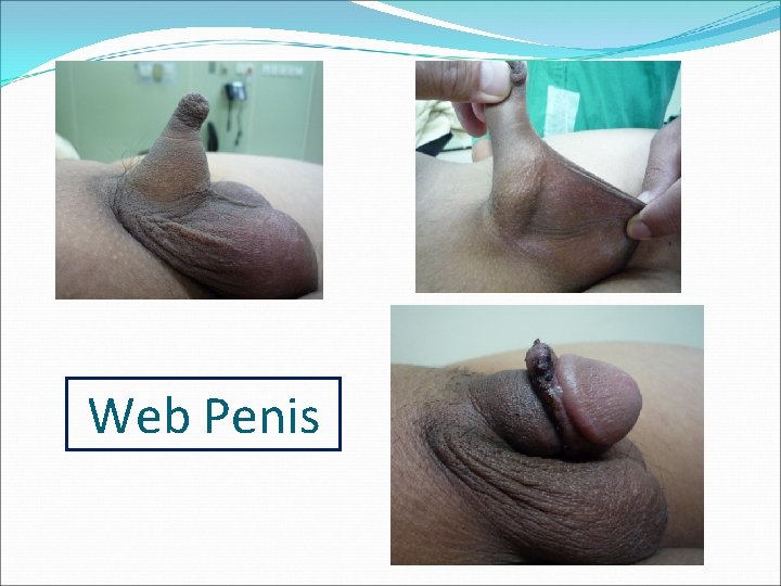 Web Penis 