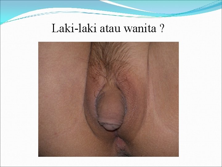 Laki-laki atau wanita ? 