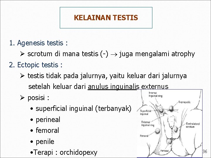 KELAINAN TESTIS 1. Agenesis testis : Ø scrotum di mana testis (-) juga mengalami
