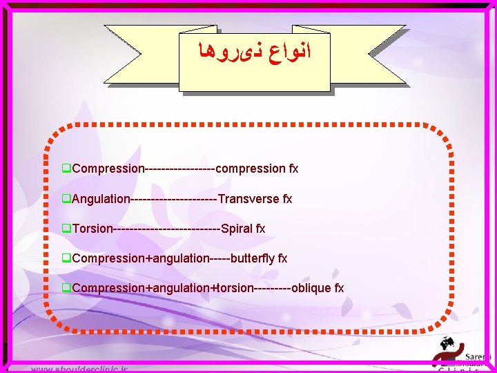  ﺍﻧﻮﺍﻉ ﻧیﺮﻭﻫﺎ q. Compression---------compression fx q. Angulation-----------Transverse fx q. Torsion-------------Spiral fx q. Compression+angulation-----butterfly