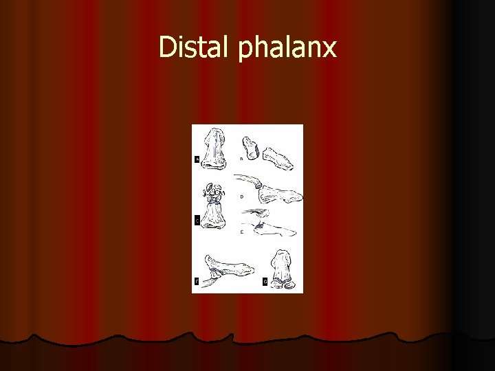 Distal phalanx 