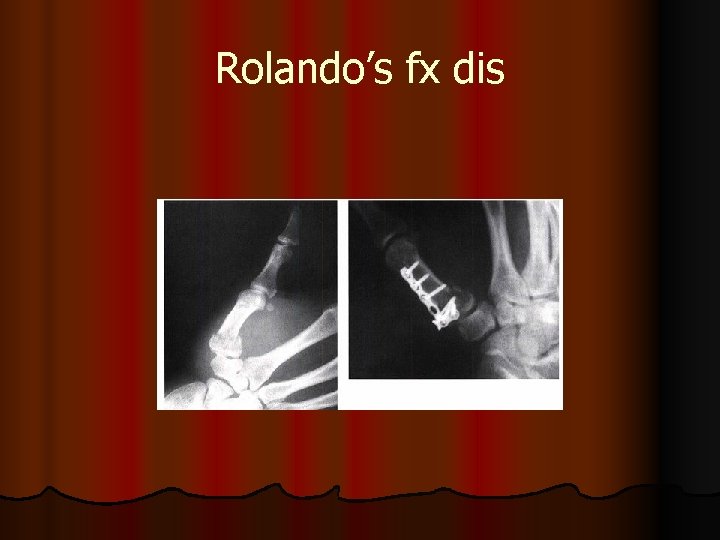 Rolando’s fx dis 