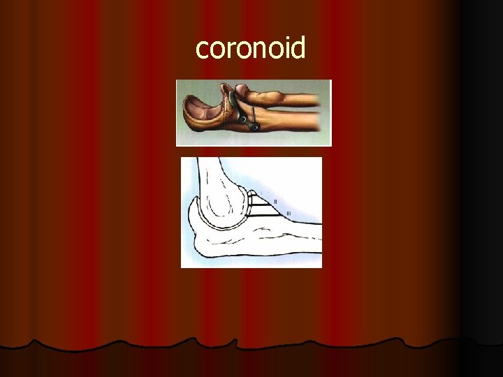 coronoid 