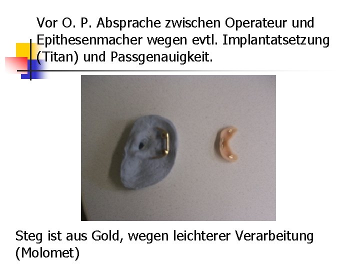 Vor O. P. Absprache zwischen Operateur und Epithesenmacher wegen evtl. Implantatsetzung (Titan) und Passgenauigkeit.