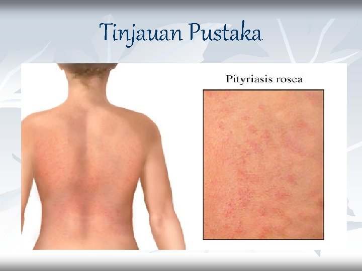 Tinjauan Pustaka 