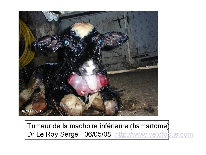 Tumeur de la mâchoire inférieure (hamartome) Dr Le Ray Serge - 06/05/08 http: //www.