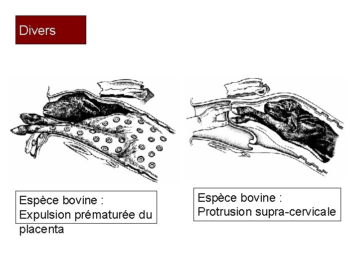 Divers Espèce bovine : Expulsion prématurée du placenta Espèce bovine : Protrusion supra-cervicale 