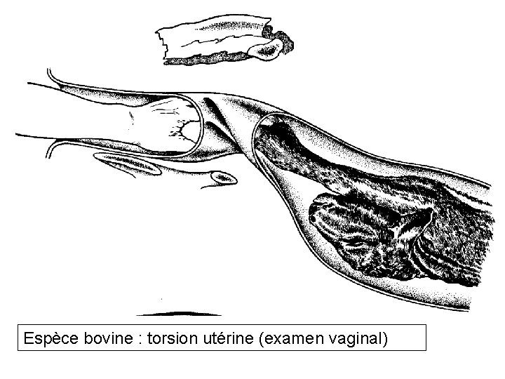 Espèce bovine : torsion utérine (examen vaginal) 