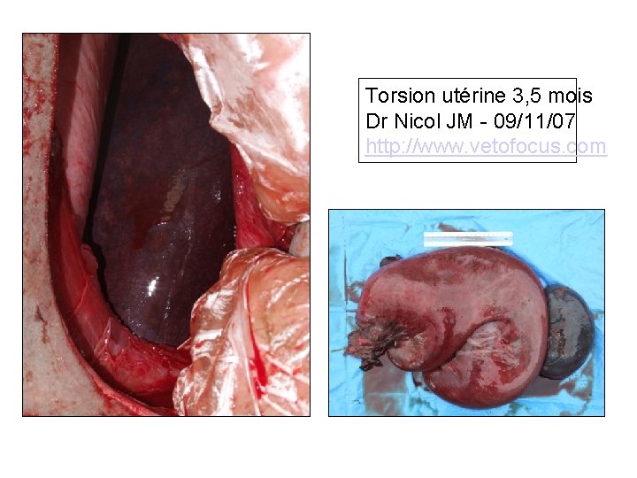 Torsion utérine 3, 5 mois Dr Nicol JM - 09/11/07 http: //www. vetofocus. com