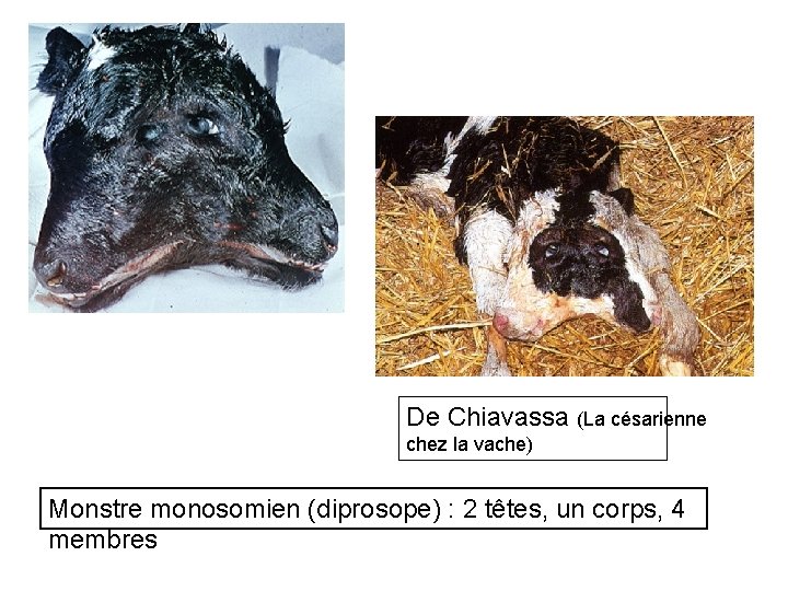 De Chiavassa (La césarienne chez la vache) Monstre monosomien (diprosope) : 2 têtes, un