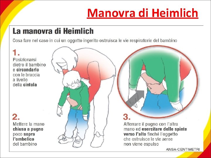 Manovra di Heimlich 