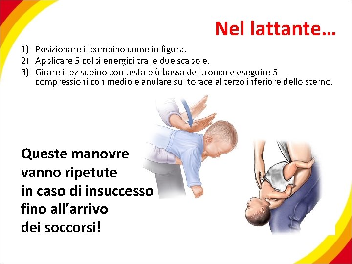 Nel lattante… 1) Posizionare il bambino come in figura. 2) Applicare 5 colpi energici