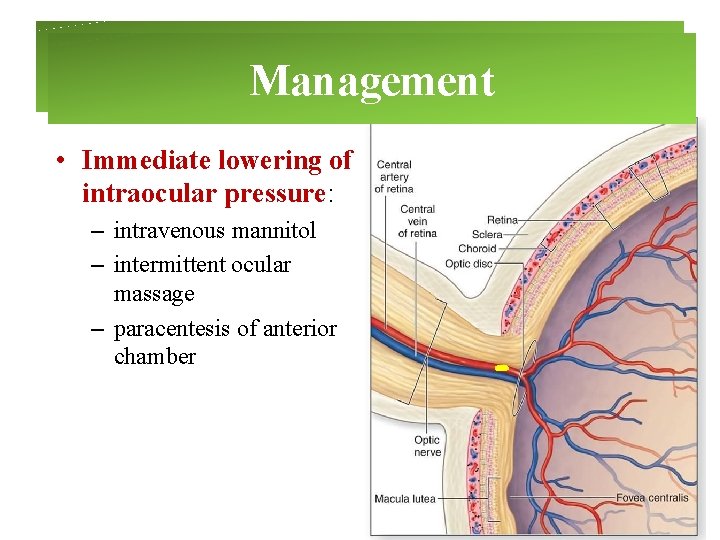 Management • Immediate lowering of intraocular pressure: – intravenous mannitol – intermittent ocular massage Management • Immediate lowering of intraocular pressure: – intravenous mannitol – intermittent ocular massage
