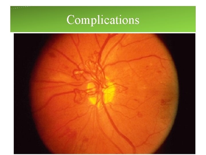 Complications Complications