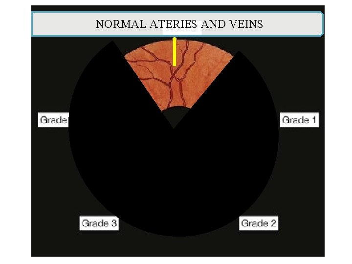 NORMAL ATERIES AND VEINS NORMAL ATERIES AND VEINS