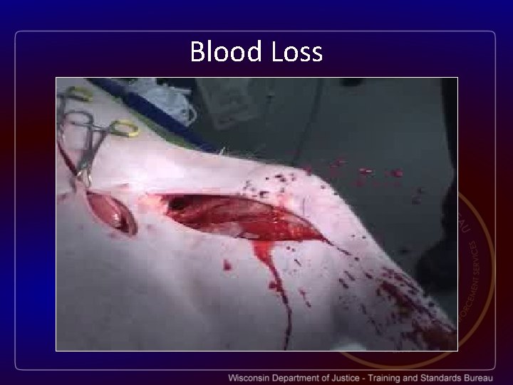 Blood Loss 