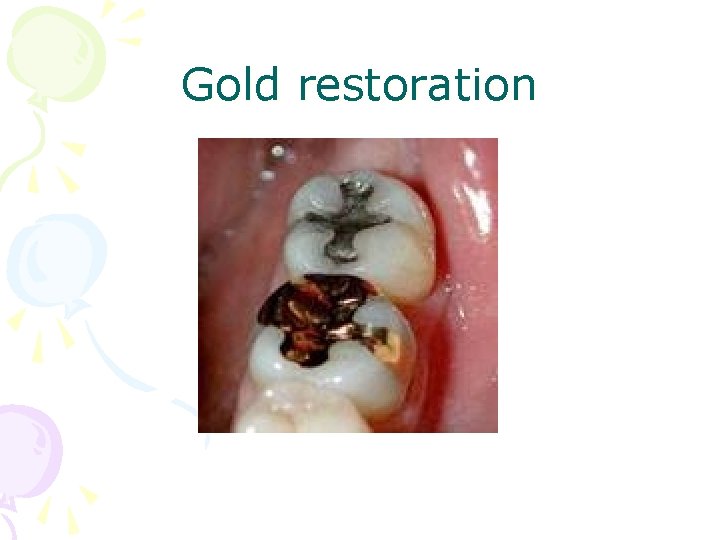 Gold restoration 