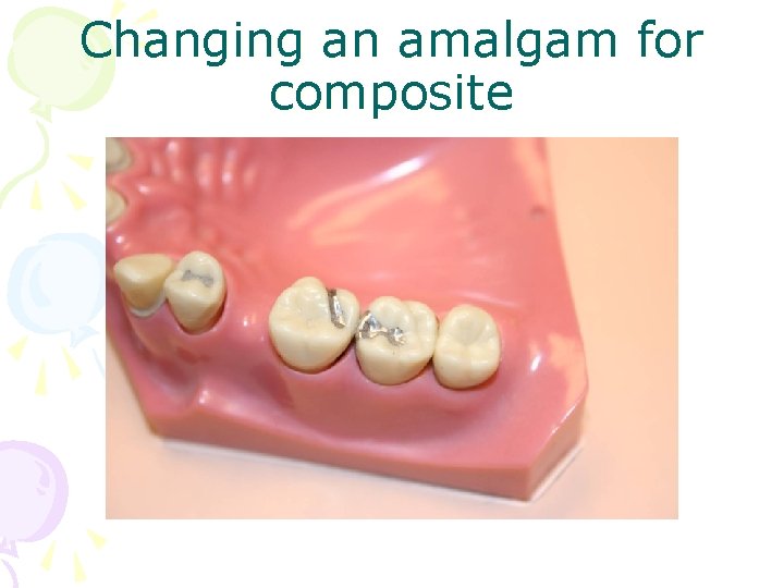 Changing an amalgam for composite 