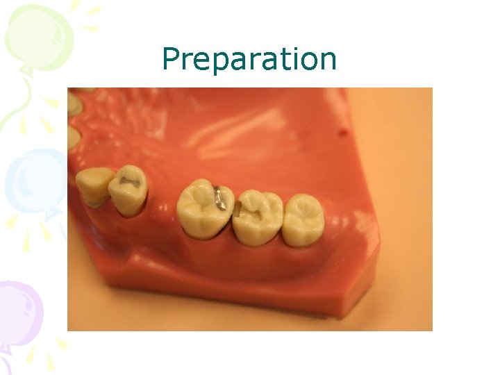 Preparation 