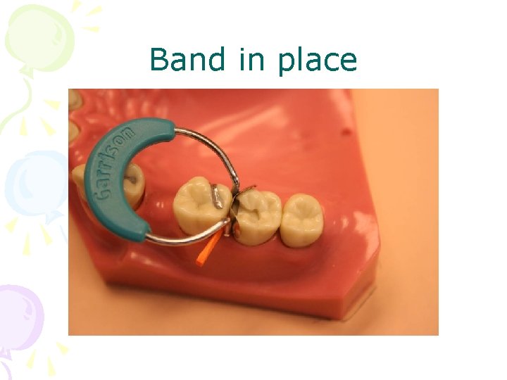 Band in place 