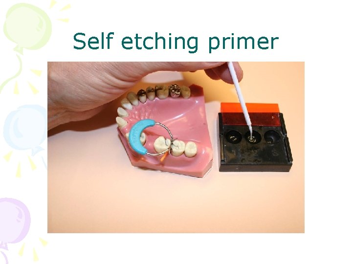 Self etching primer 