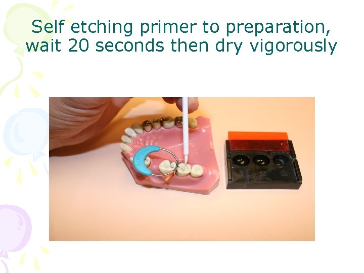 Self etching primer to preparation, wait 20 seconds then dry vigorously 