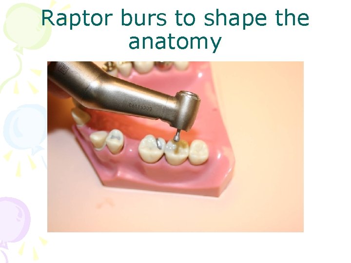 Raptor burs to shape the anatomy 