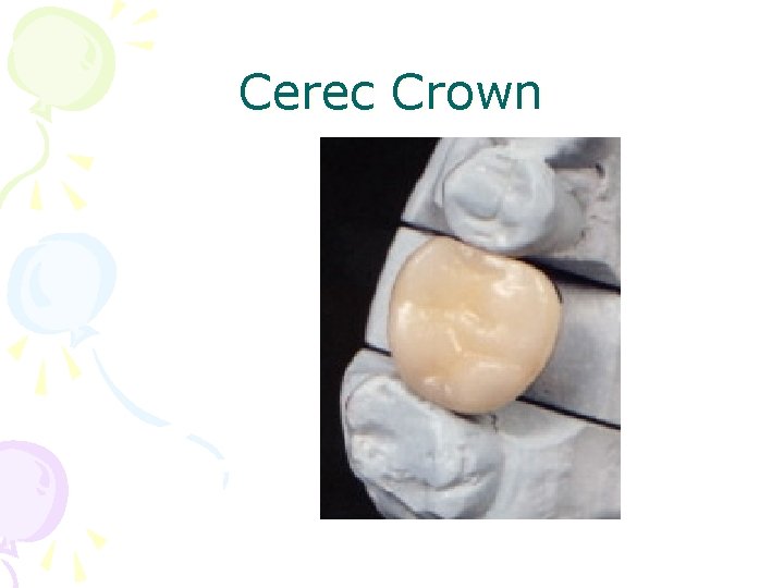 Cerec Crown 