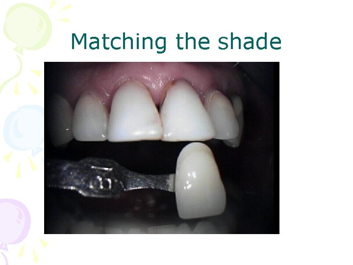 Matching the shade 