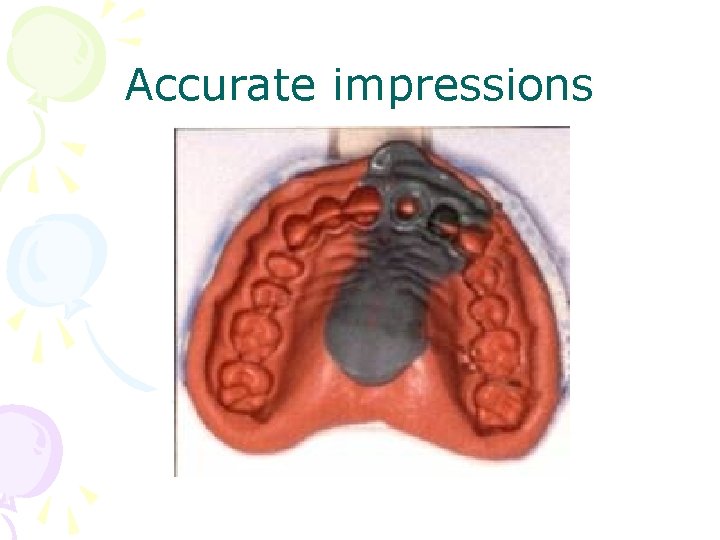 Accurate impressions 