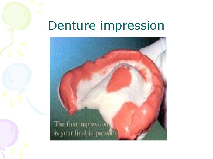Denture impression 