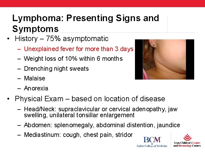 Lymphoma: Presenting Signs and Symptoms • History – 75% asymptomatic – Unexplained fever for